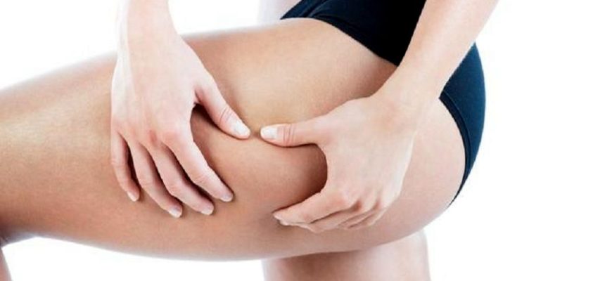 Как избавиться от целлюлита. 8 советов